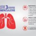 Tuberculose: Prefeitura de Selvíria oferece atendimento nas unidades de saúde